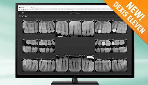 » Dexis Eleven Software Drives Efficiency in and out of Operatory With